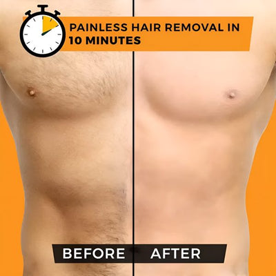 Chris's Hair Removal Spray For Men – 180ml